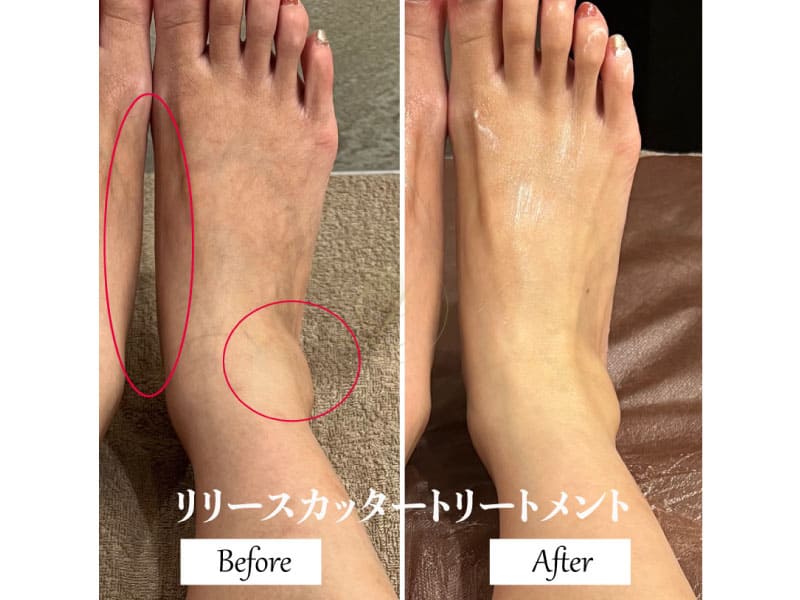 リリースカッター ビフォーアフター画像