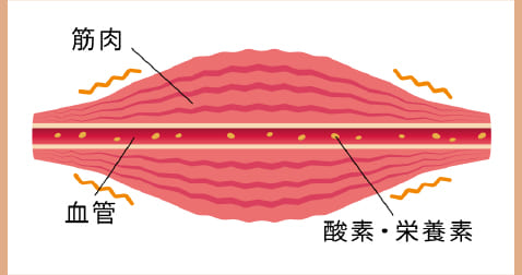 肩こりが起きている体の状態 画像